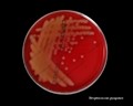 streptococcus pyogenes